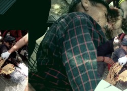बर्दियामा गैँडाको आक्रमणमा परि गहनु थारु गम्भीर घाइते, मिर्गौला र पेटमा प्वाल