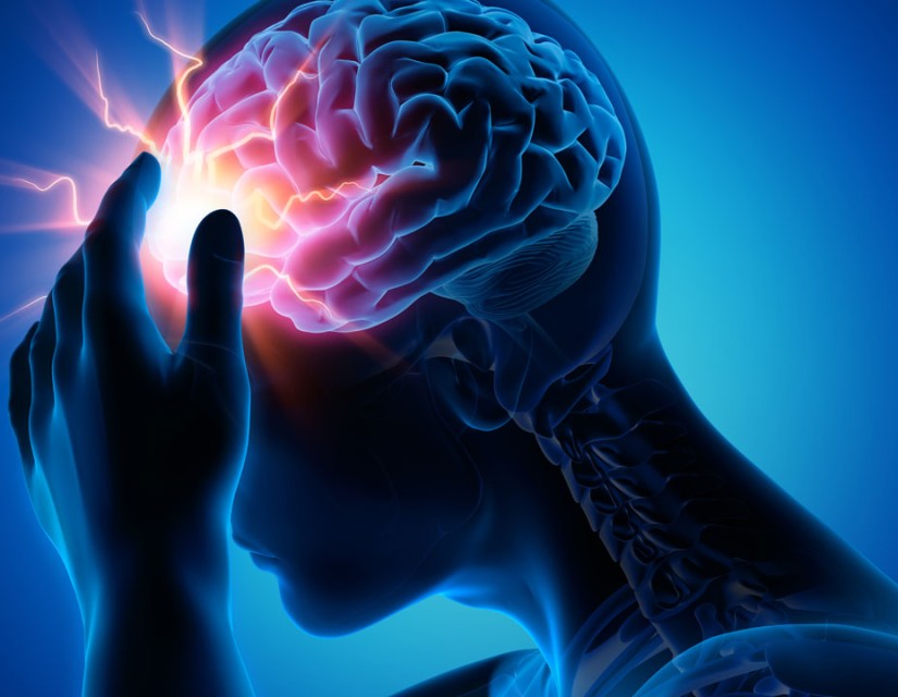 मस्तिष्काघात : ‘समयमै विशेषज्ञ उपचार पाए पूर्ववत् अवस्थामा फर्किन सकिन्छ’